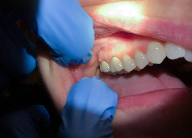 Reliable NC Emergency Dental Service Solutions