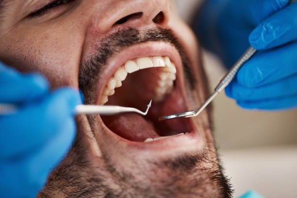 Best Emergency Treatment for Oral Infections in Horse Shoe, NC